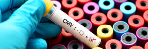 What Is CMV And How Can It Affect My Pregnancy?