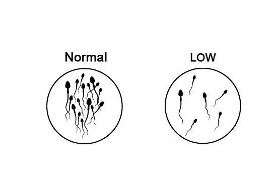 Recent Studies Show Decline in Sperm Counts in Richer Countries