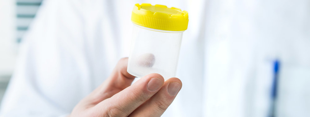 Why are Donor Samples Held in Quarantine for Six Months?