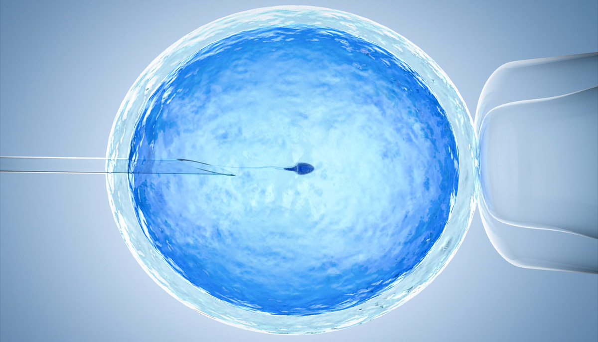 How is Donor Sperm Used for Insemination?